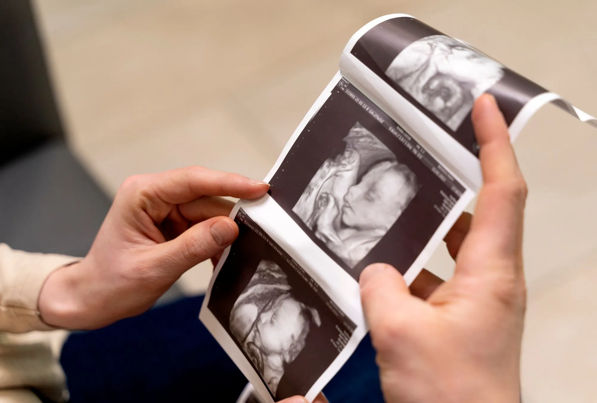 Hands holding ultrasound images of baby